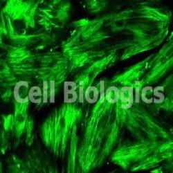 Porcine Smooth Muscle Cells (14)